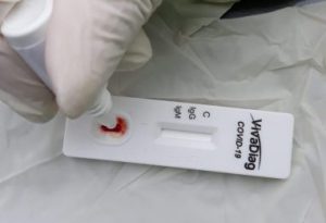 L’Italia in prima linea nella lotta al Coronavirus: Test rapido salivare.